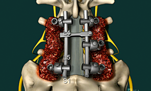 Medical Legal Animation