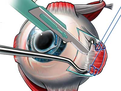 Medical Legal Art