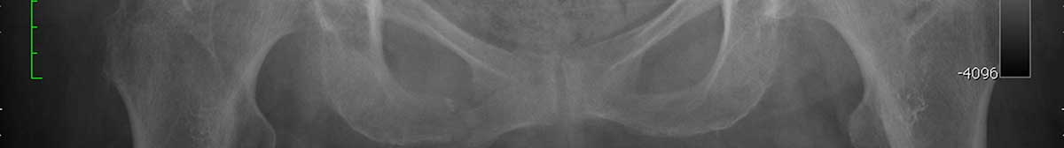 Client X-Ray