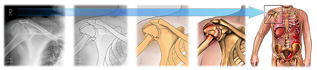Medical Legal Art Process