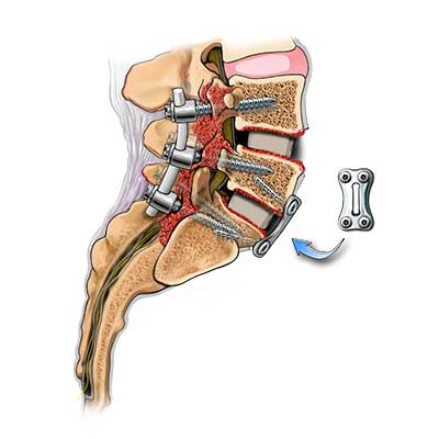 Surgical